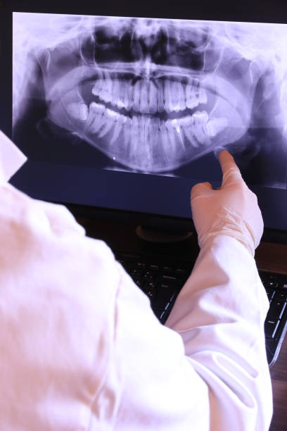 Best Knocked-Out Tooth (Avulsed Tooth) Treatment in Cresson, TX