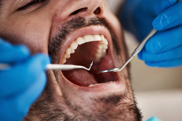 Best After-Hours Dental Care in Cresson, TX